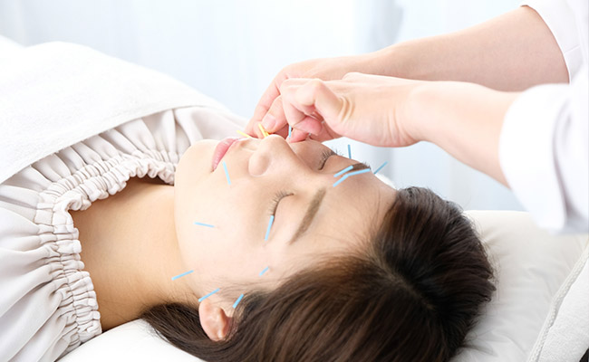 美容鍼の施術実績も豊富